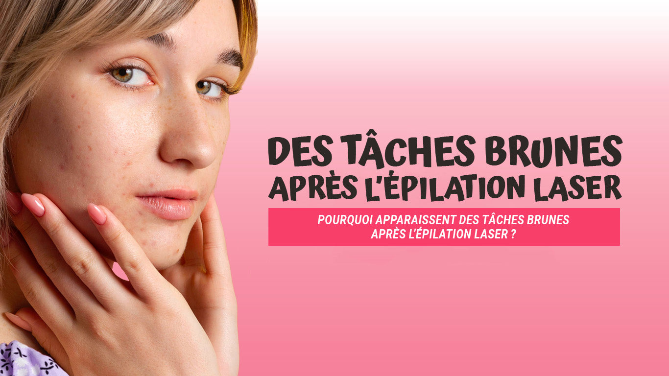 tache brune apres epilation laser