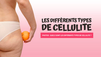 Photos : quels sont les différents types de cellulite