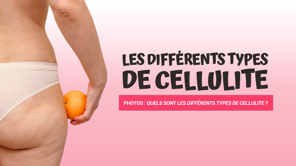 différents types de cellulite photos